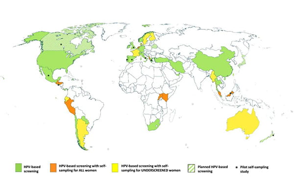 HPV自采样在全球用于宫颈癌筛查.jpg